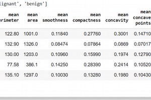 AI-Based Breast Cancer Detection System