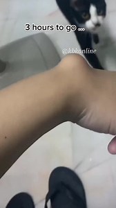 Ganglion cyst a.k.a bible cyst. A non-cancerous lump, often on the tendons or joints of wrists and hands. The cause of ganglion cysts is unknown. Can be drained or surgically removed. #kbkfoundation | Kbkonline