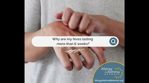 Do you or someone you care about have hives? Round and swollen welts on the skin? Do they show up when you least expect them and last for more than six weeks? It could be chronic hives, also known as chronic urticaria. If this may be you or someone you love, do not worry. Allergy & Asthma Network has compiled information that is easy to understand about chronic urticaria management, treatment, and more! Visit ChronicHives.info for more | Allergy & Asthma Network | Facebook