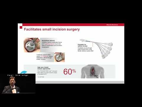 Edwards Intuity Elite Valve System