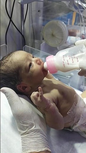 “Correct Position to Feed a Baby in NICU 🍼 | Let’s See!”#viralvideo