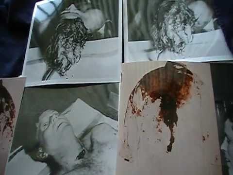 JFK autopsy photos---Kennedy Detail Killed President Kennedy