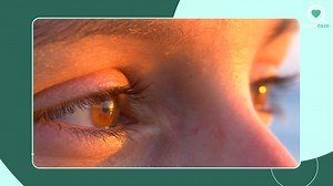 What causes styes in the eyes? - Sharecare