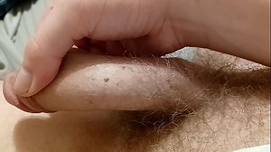 STD HPV Genital Warts