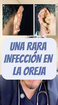 👂 A rare disease: Lobomycosis