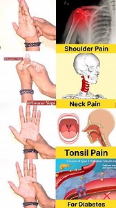 1.4M views · 8.8K reactions | 4 Best Hand Acupressure Points Massage...