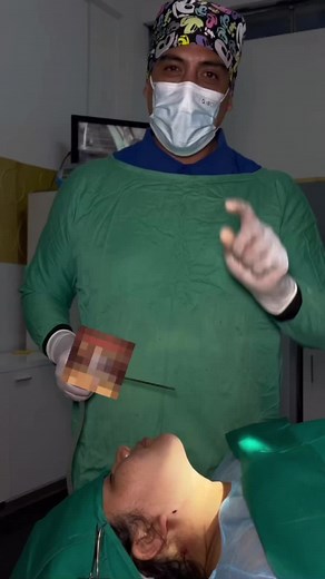 ¡Luce un rostro más definido y juvenil! 😍✨ Aprovecha nuestra promoción exclusiva de Liposucción de Papada Contorno Mandibular por solo 1500 Bs 💸. Resalta tu belleza con este tratamiento que te dará una mandíbula más estilizada y libre de grasa no deseada 💆‍♀️💎. 🔹 Beneficios: Adiós a la papada y hola a un rostro esculpido 😌 Procedimiento rápido y sin complicaciones ⏱️ Resultados visibles en poco tiempo 💥 DR. ALFREDO HURTADO🦷 Puedes pedir cualquier informacion o agendar una consulta al 766