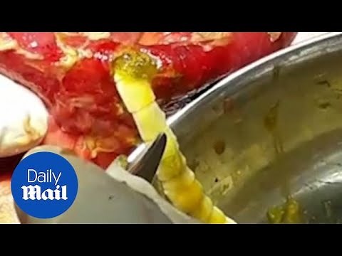 Believe it or not! 6-foot-long tapeworm found in man's intestine