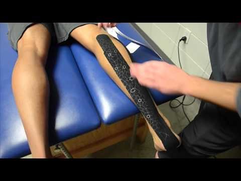 Calf Strain/Achilles Kinesiology Taping - University of Florida