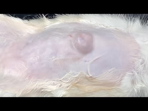 Tuition video showing repair of large umbilical hernia where peristalsis of the intestine is seen