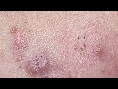 Relax Every Day With Sac Dep Spa #0265