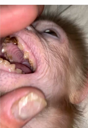 The Consequences of Not Brushing Your Teeth