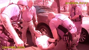 These brutal police dog attacks were captured on video. Now some cities are curtailing K-9 use.