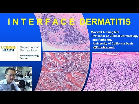 DERMATOPATHOLOGY: Interface Dermatitis
