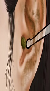 64K views · 271 reactions | ASMR Treatment of a girl's foot inflammation and trimming long toenails | Erin Stevens | Facebook