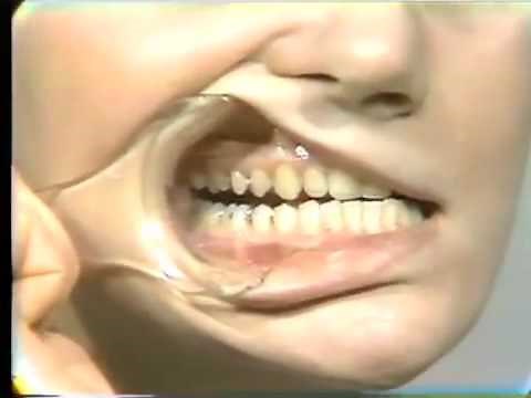 Determinants of Occlusal Morphology