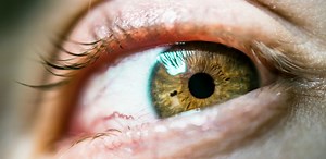 How To Reduce Eye Floaters Naturally? All Natural Remedies - Eyes Advisor