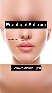 The Rarest Human Genetics 😳