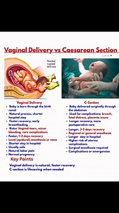 Vaginal Delivery vs Caesarean Section 🤰👶🧐🩺👇 #healthcare #HealthEducation #pregnancy #nursingschool #nursingstudentlife #registerednurse #MedicalEducation #nursing #newmomlife #laboranddelivery #nursingstudent #nurses #medicalinformation | Ma Vickie