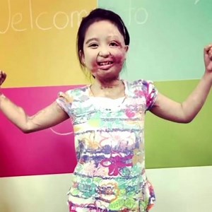 Like so many children, Alliyah's life-altering kitchen burn injury...