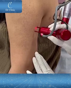 1.8K views | Dr clinic on Reels | Facebook