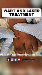 Surgical Wart And Laser Treatment | Miss Foot Fixer | Marion Yau #surgicalwart #lasertreatment #missfootfixer #toenailfungustreatment | Miss Foot Fixer