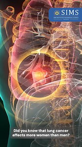 45 reactions | Lung Cancer Affects Women More Than Men - SIMS...