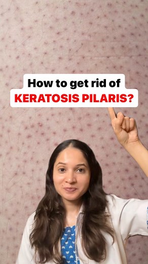 7.8K views · 13 comments | SAVE & SHARE THIS VIDEO ❤️ Keratosis...