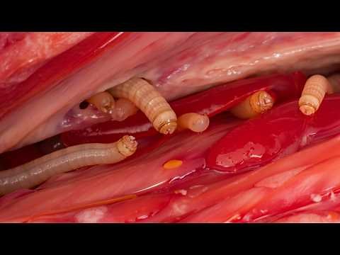 Top 10 Most Terrifying Parasites That Live in Humans