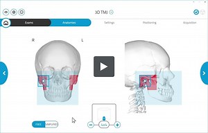 GiANO HR 3D TMJ Scan