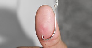 How To Remove A Fish Hook From Hands, Fingers & Skin?