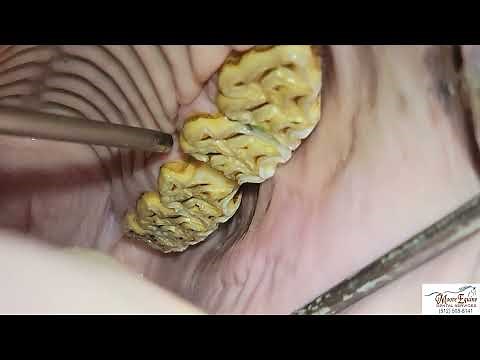 Long term care after horse has tooth pulled