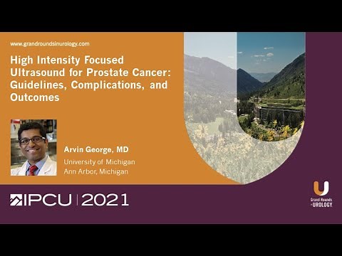 High Intensity Focused Ultrasound for Prostate Cancer: Guidelines, Complications, and Outcomes