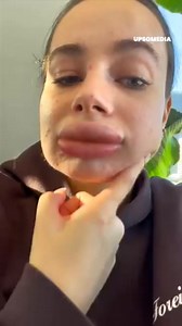 11K views · 119 reactions | Allô Docteur on Reels | Facebook