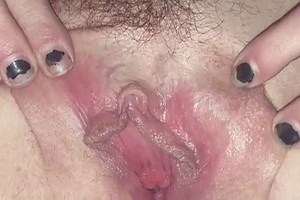 from Hairy Bush to Smooth Bald