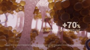 LPG endermologie on Reels | Facebook