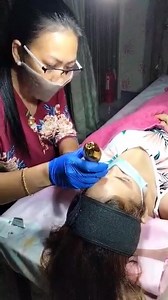 Fibroblast Session on A Sunday.. Non Invasive Painless Eyelid Lifting and Wrinkles Removal.. | M&D Medical Spa for men&women