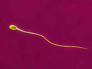 Everything Your Should Know About Posthumous Sperm Retrieval