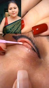 Eye lens side effects #viralreelschallenge #facebookviral #reelschallenge | Sobita Singha