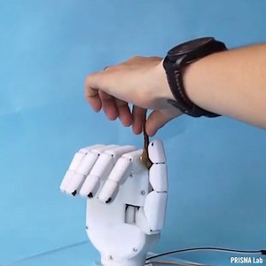 This innovative prosthetic hand offers increased mechanical robustness💪 | Interesting Engineering