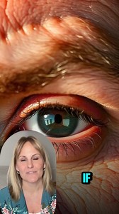 If you have any of the following symptoms, you should try AURIC LIVER DETOX. ❌ GAS IN THE STOMACH ❌ FREQUENT FARTING ❌ BAD BREATH ❌ YELLOW URINE ❌ VERTICAL LINES ON NAILS Made with over 10 natural liver supporting HERBAL ingredients such as Milk Thistle, Green Tea, & Turmeric. Just drop a tablet in water, let it fizz, & enjoy the benefits | Auric | Facebook