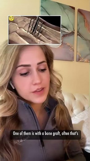 Foot doctor explains: Brachymetatarsia surgery. How to "fix" a short toe!