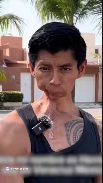 Hernel beat cancer, but lost his jaw in the process... and now he's asking for help. | Cultura Colectiva