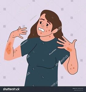 Woman Skin Disease Concept Skin Rash Stock Vector (Royalty Free) 2240519745 | Shutterstock