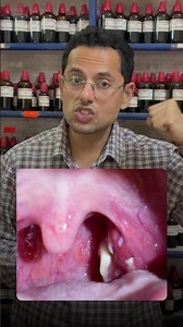 #tonsillitis #tonsillitisrelief #tonsillitisawareness #sorethroat #throatinfection #throatpain