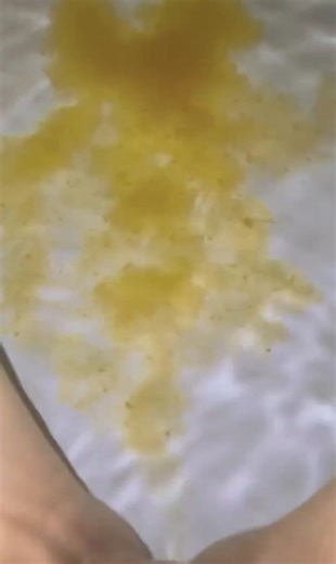 Scat Diarrhea in Pool