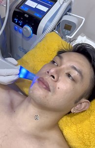 Rediscover your confidence with Exilis: where beauty meets science, and results speak volumes. Exilis is a non-invasive aesthetic treatment that uses radiofrequency (RF) energy to tighten skin and reduce fat. It's often used for body contouring, wrinkle reduction, and skin tightening without surgery or downtime. Book your appointment now! | KAVE Aesthetics