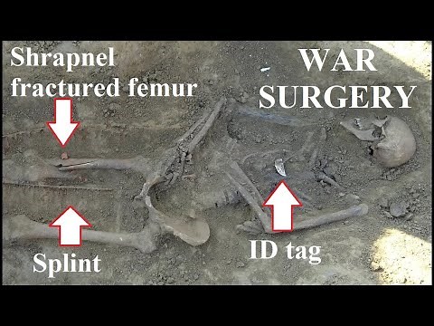 Exhumation of 25 German soldiers from a 1945 field hospital cemetery on the Eastern Front