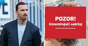 Ibrahimović rasjekao glavu. Objavio uznemirujuće fotke