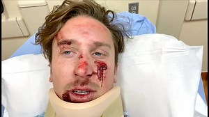 6.1K views · 165 reactions | Face busted, but helmet's safe 勞 | Buttery Films | Facebook